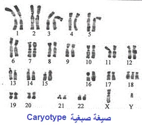 caryotype