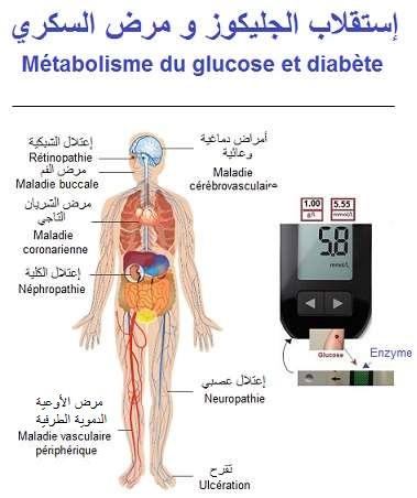 Glucose  (sucre, glucide) et diabeète