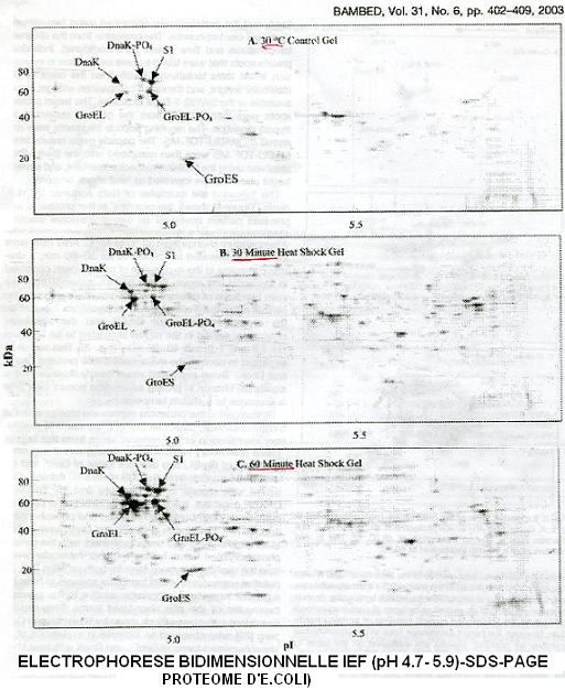 électrophorèse 2D, protéomiqu